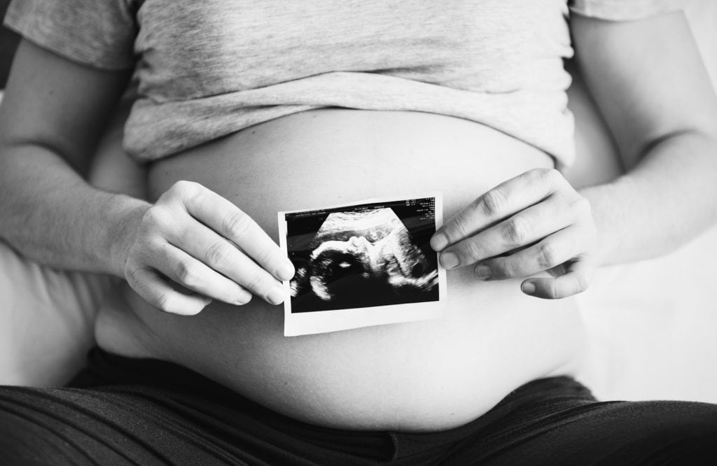 Pregnancy scan photo