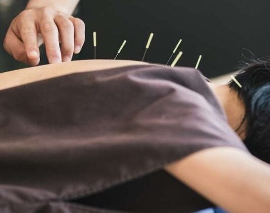 Acupuncture: for more than just labour induction