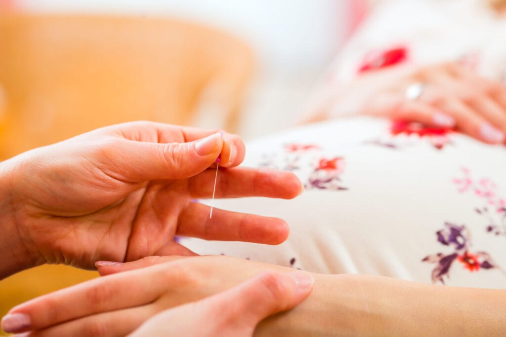 Midwife giving acupuncture to pregnant woman